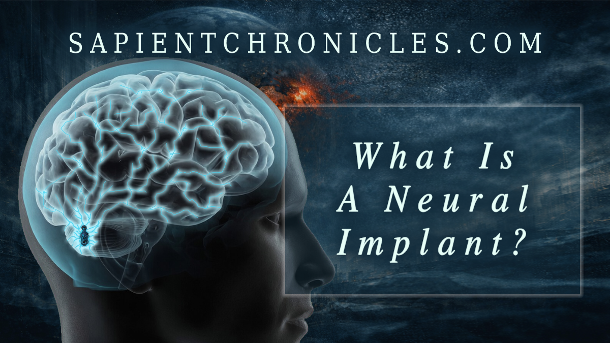 What Is a Neural Implant, and Why Would Anyone Want One?
